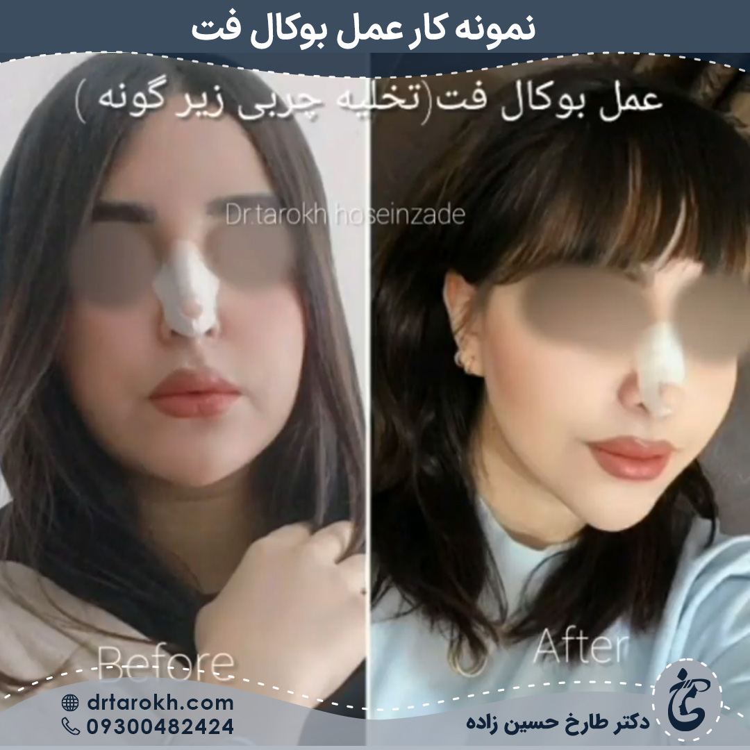 عمل بوکال فت در شیراز