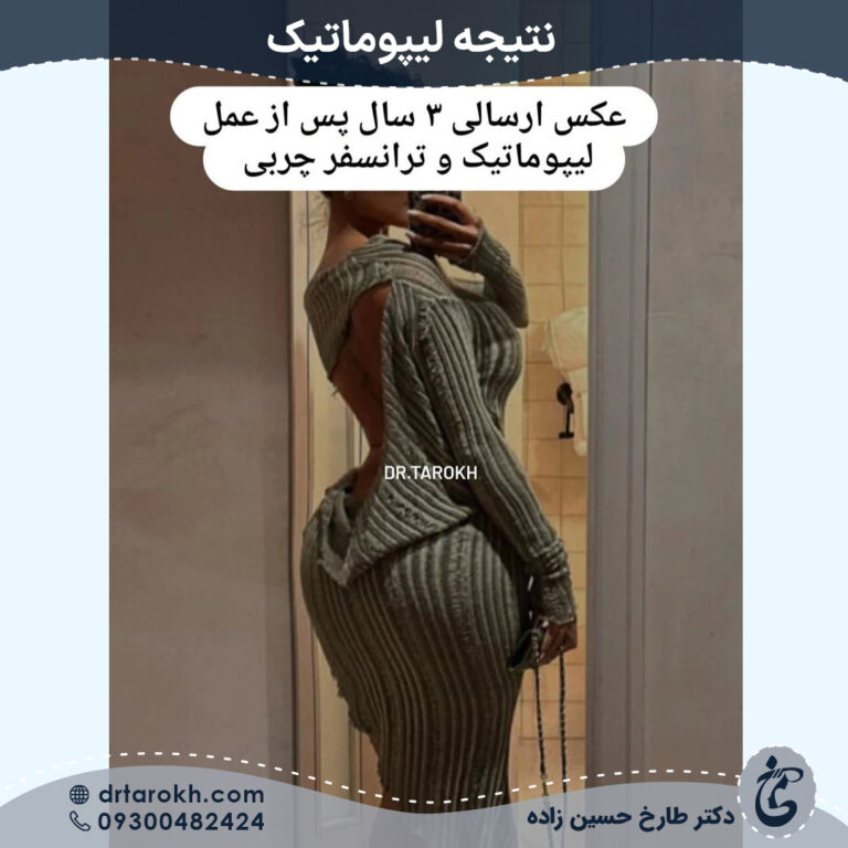 لیپوماتیک شیراز