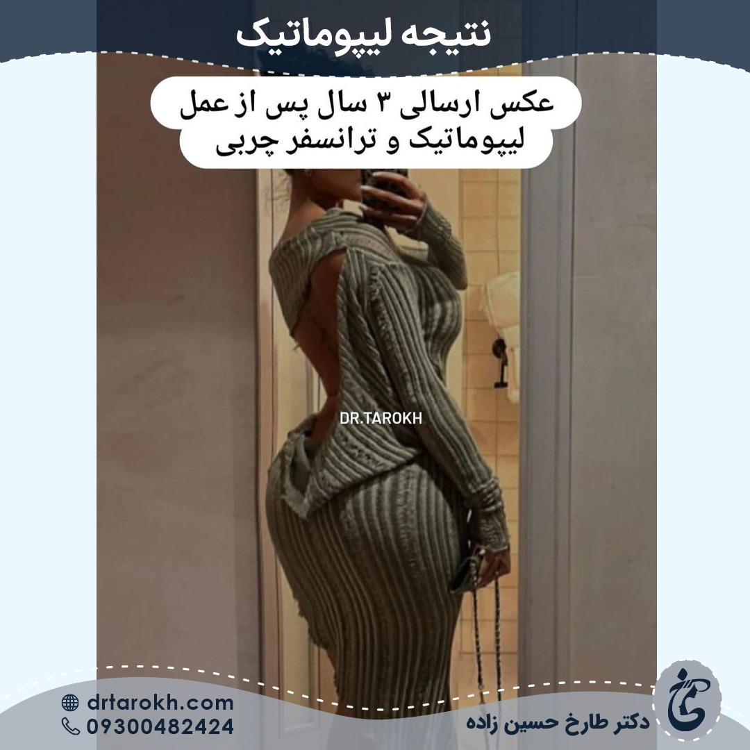 لیپوماتیک شیراز