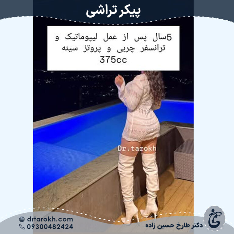 پیکرتراشی در شیراز